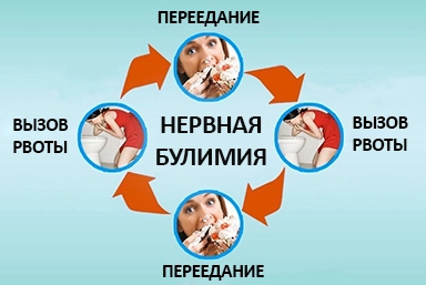 Лечение булимии в Новоорске